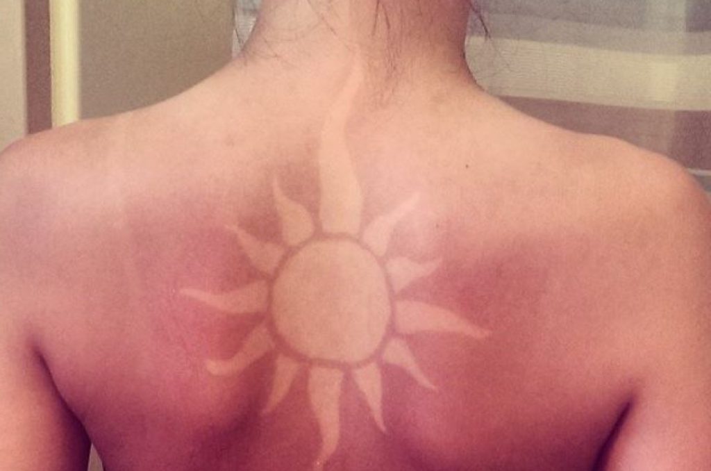 Tips To Prevent Tattoo Sunburn